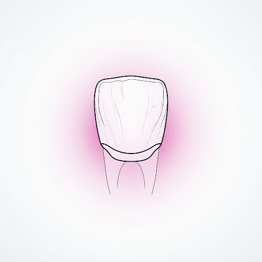Precision-crafted porcelain dental crown