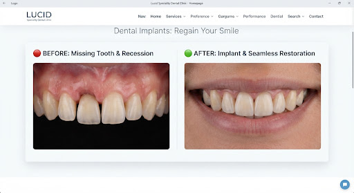 Restorative Implantology — before and after result